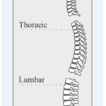 DME Claims Audits of Back Braces Are Expected 