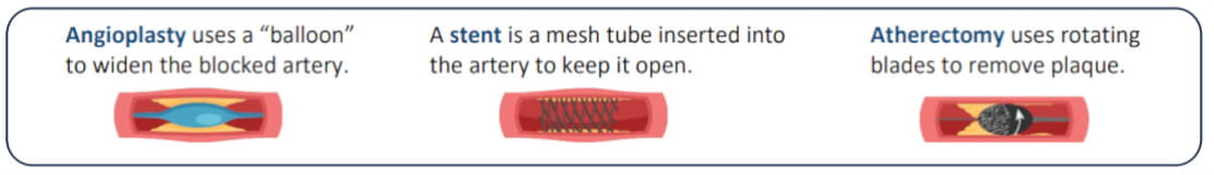 Peripheral vascular procedures performed in an office-based laboratory are currently being audited - Liles Parker